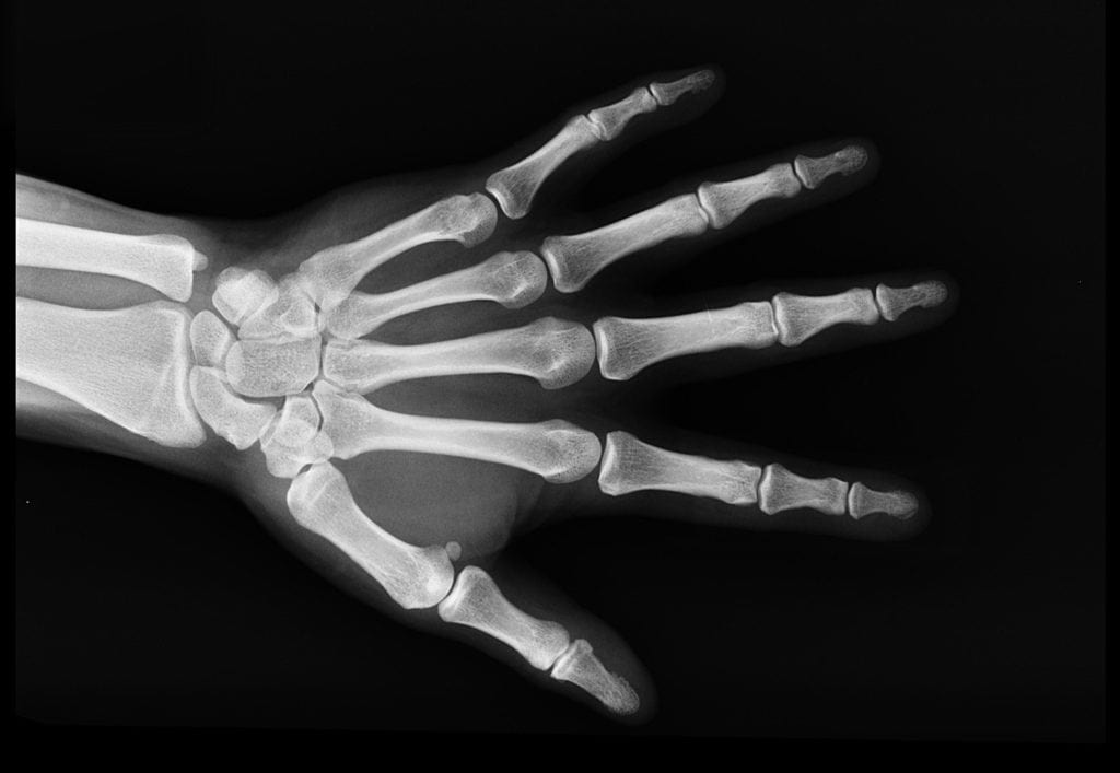 bone-density-scan